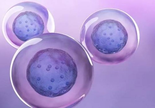 易發唐氏兒的孕婦群體，做好預防措施必不可少